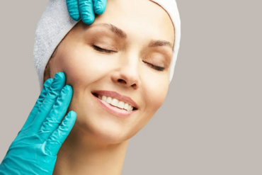 kobieta przed zabiegiem liftingu twarzy