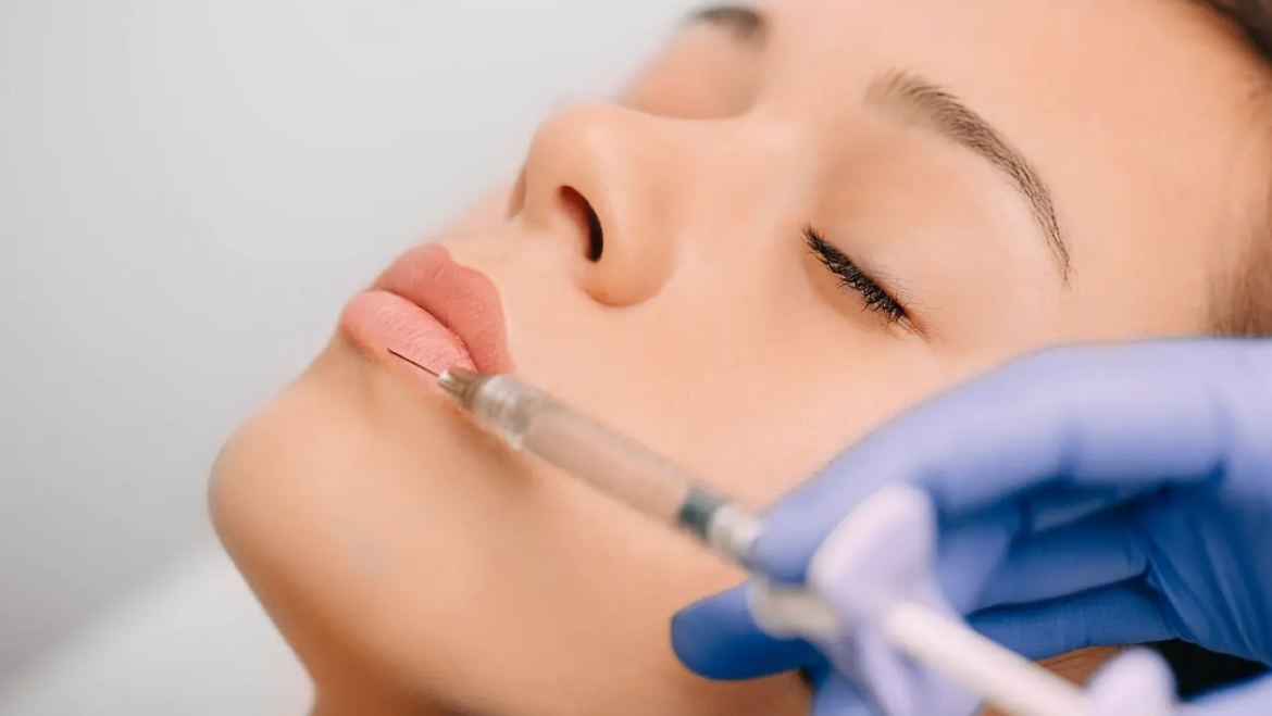 zabieg powiększania ust